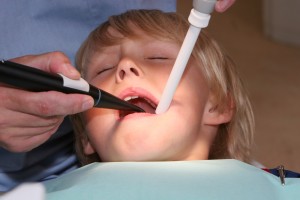 will it hurt  Children’s Cavities- What Can You Do About Them? Childrens Cavities What Can You Do About Them
