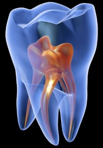 root canal Waltham Belmont Cambridge MA